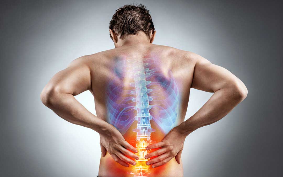 what Is Herniated Disc Lower Back