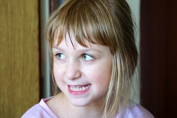 Fragile X Syndrome in children